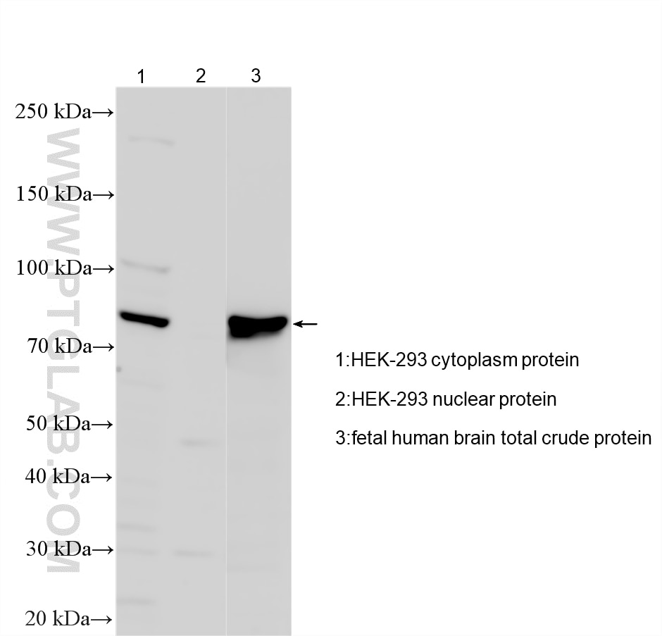 WB analysis using 27179-1-AP Western Blot (WB) analysis of various lysates using ZDHHC8 Polyclonal antibody (27179-1-AP)