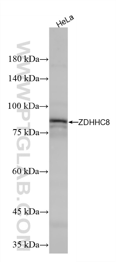 Western Blot (WB) analysis of HeLa cells using ZDHHC8 Recombinant monoclonal antibody (86572-2-RR)