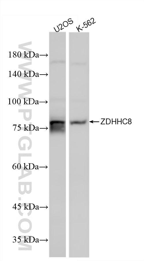 Western Blot (WB) analysis of various lysates using ZDHHC8 Recombinant monoclonal antibody (86572-2-RR)