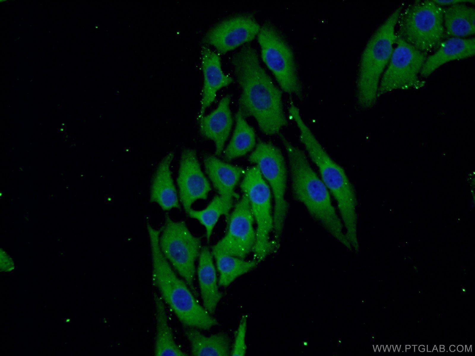 Immunofluorescence (IF) / fluorescent staining of SH-SY5Y cells using ZDHHC9 Polyclonal antibody (24046-1-AP)