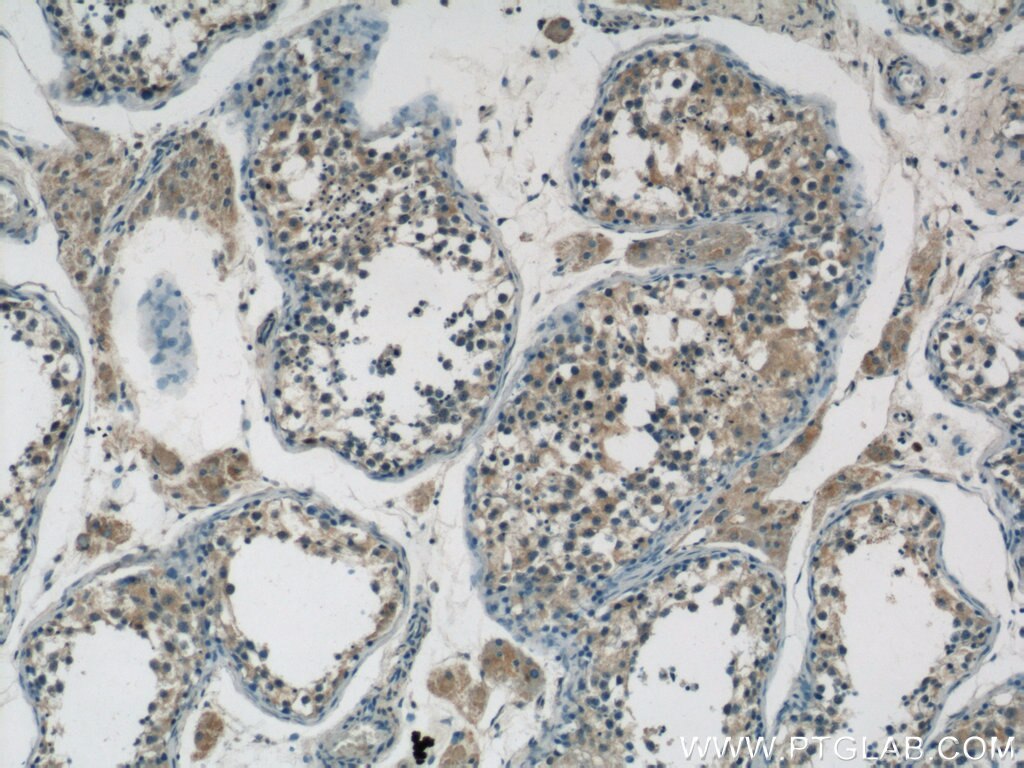Immunohistochemistry (IHC) staining of human testis tissue using ZDHHC9 Polyclonal antibody (24046-1-AP)