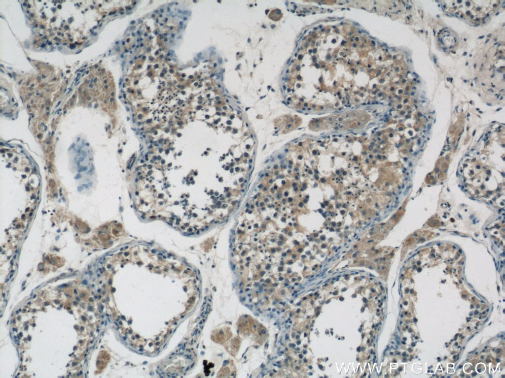 IHC staining of human testis using 24046-1-AP