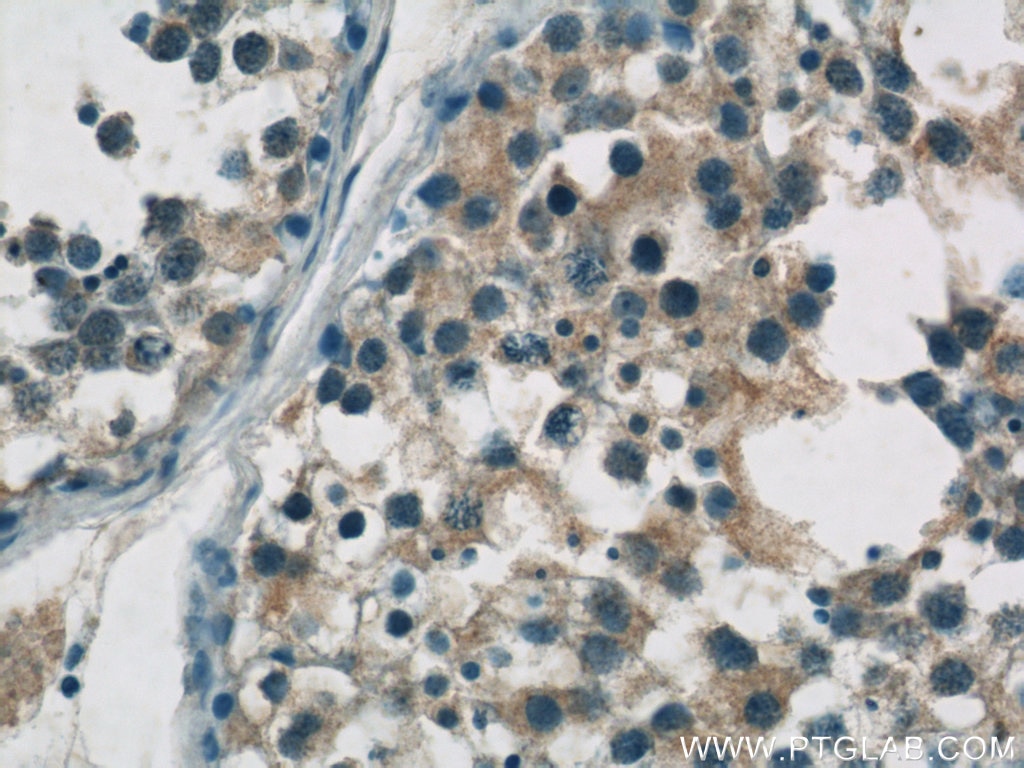 Immunohistochemistry (IHC) staining of human testis tissue using ZDHHC9 Polyclonal antibody (24046-1-AP)