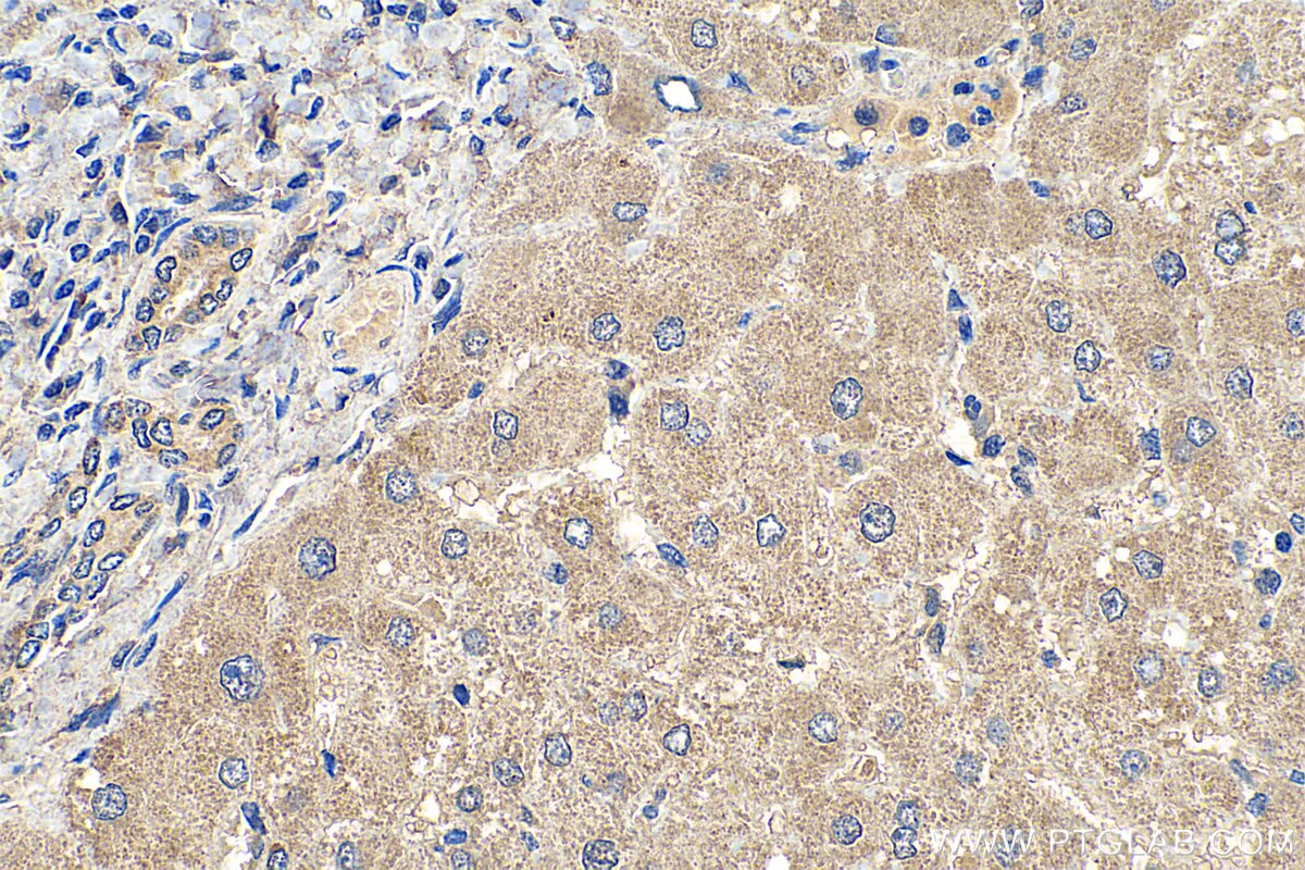 Immunohistochemistry (IHC) staining of human liver tissue using ZDHHC9 Polyclonal antibody (24046-1-AP)