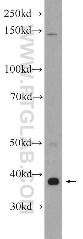 Western Blot (WB) analysis of SH-SY5Y cells using ZDHHC9 Polyclonal antibody (24046-1-AP)