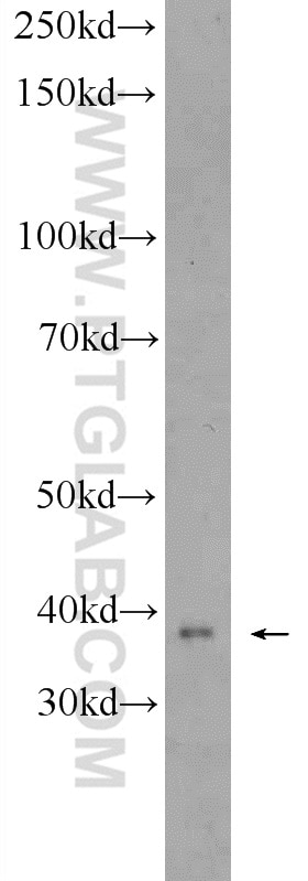 Western Blot (WB) analysis of mouse liver tissue using ZDHHC9 Polyclonal antibody (24046-1-AP)