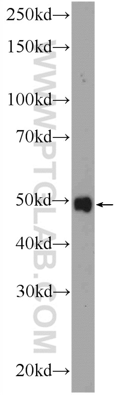 Western Blot (WB) analysis of mouse brain tissue using ZDHHC9 Polyclonal antibody (24046-1-AP)