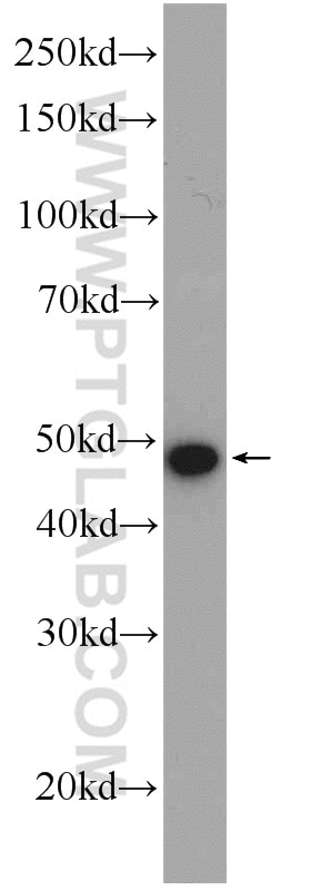 Western Blot (WB) analysis of mouse skeletal muscle tissue using ZDHHC9 Polyclonal antibody (24046-1-AP)