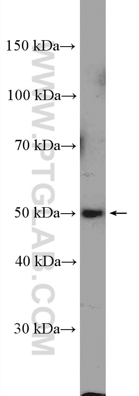 Western Blot (WB) analysis of mouse brain tissue using ZDHHC9 Polyclonal antibody (24046-1-AP)