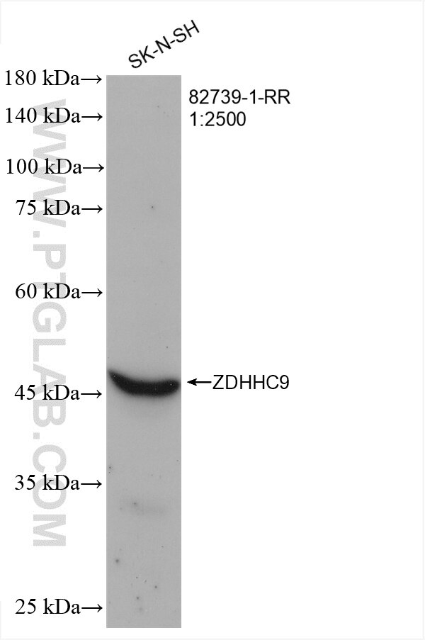 Western Blot (WB) analysis of various lysates using ZDHHC9 Recombinant antibody (82739-1-RR)