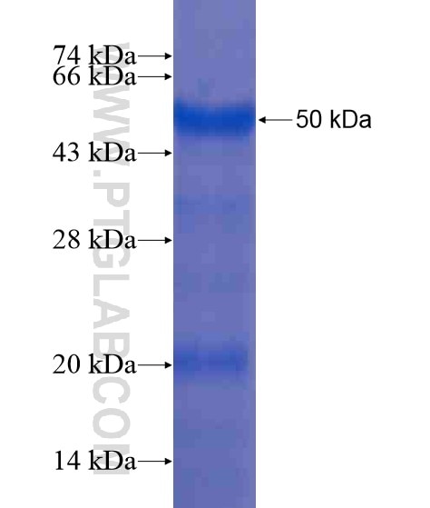 ZDHHC9 fusion protein Ag20881 SDS-PAGE