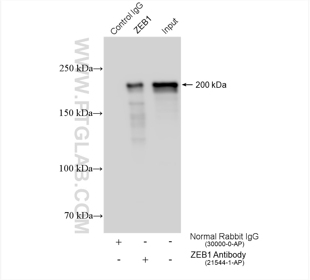 Immunoprecipitation (IP) experiment of COLO 320 cells using ZEB1 Polyclonal antibody (21544-1-AP)