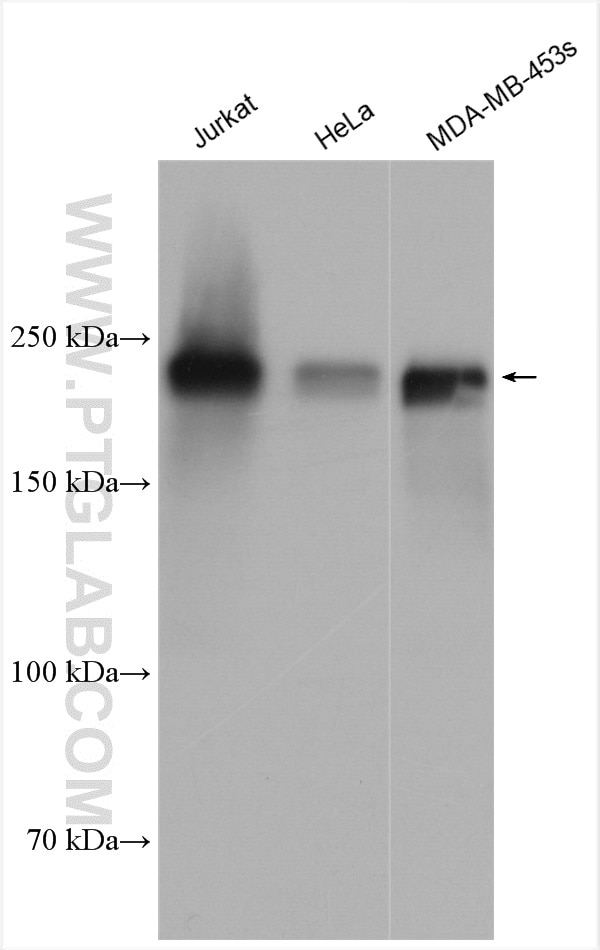 Western Blot (WB) analysis of various lysates using ZEB1 Polyclonal antibody (21544-1-AP)