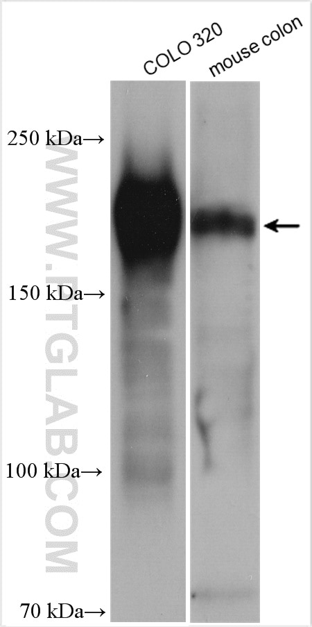 Western Blot (WB) analysis of various lysates using ZEB1 Polyclonal antibody (21544-1-AP)