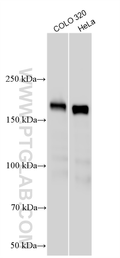 WB analysis using 21544-1-AP Western Blot (WB) analysis of various lysates using ZEB1 Polyclonal antibody (21544-1-AP)