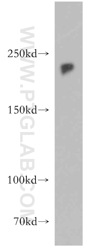 Western Blot (WB) analysis of MCF-7 cells using ZEB1 Polyclonal antibody (21544-1-AP)