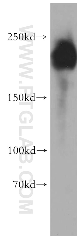 Western Blot (WB) analysis of PC-3 cells using ZEB1 Polyclonal antibody (21544-1-AP)