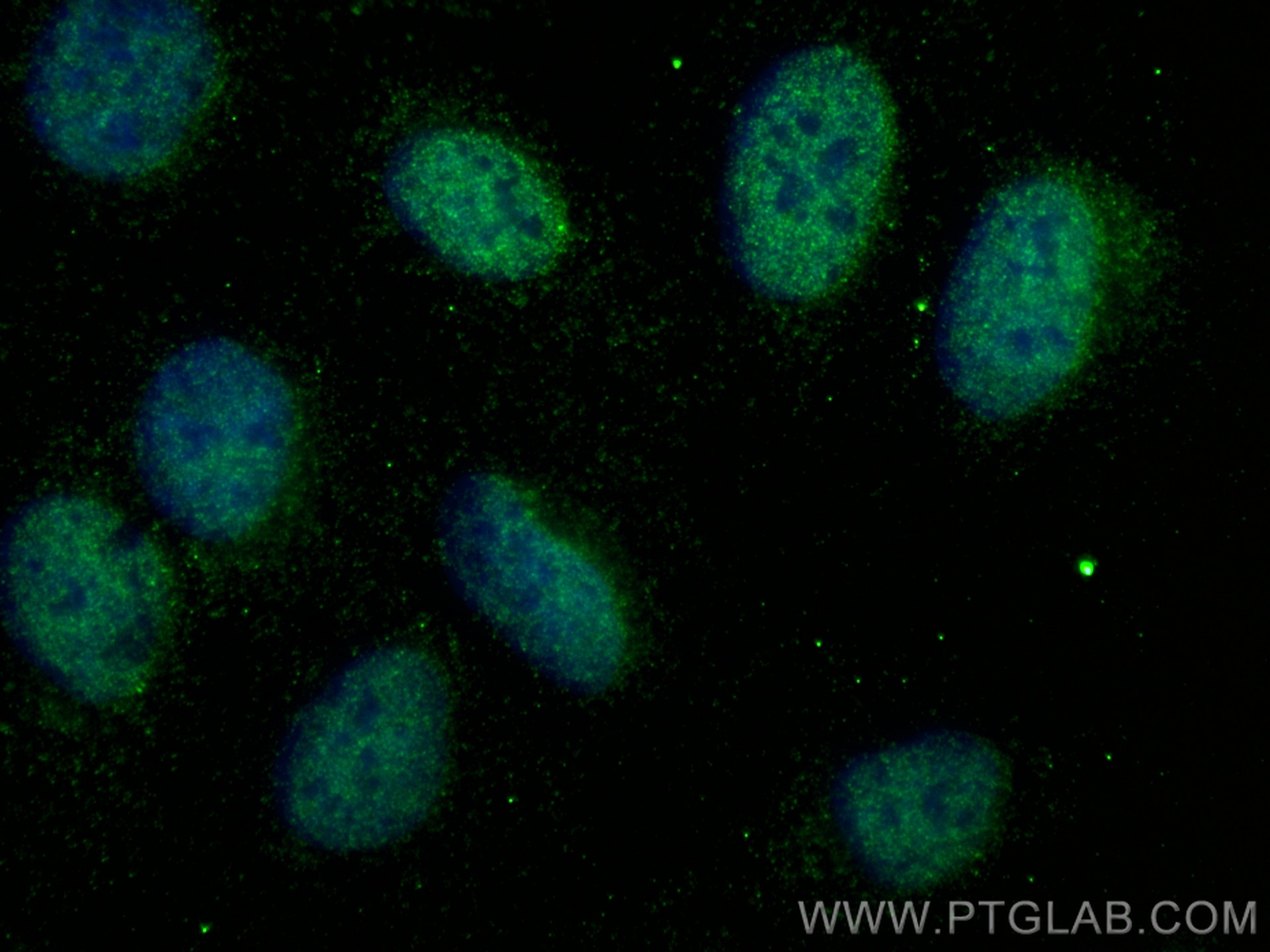 Immunofluorescence (IF) / fluorescent staining of U2OS cells using ZEB1 Monoclonal antibody (66279-1-Ig)