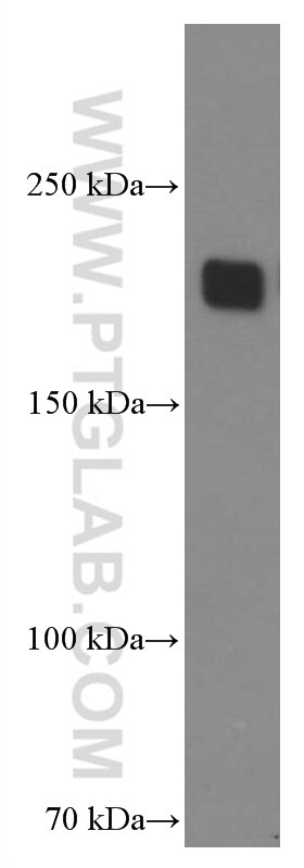 Western Blot (WB) analysis of HeLa cells using ZEB1 Monoclonal antibody (66279-1-Ig)