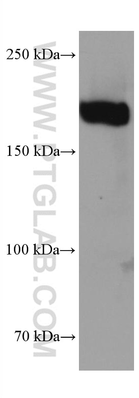 Western Blot (WB) analysis of Jurkat cells using ZEB1 Monoclonal antibody (66279-1-Ig)