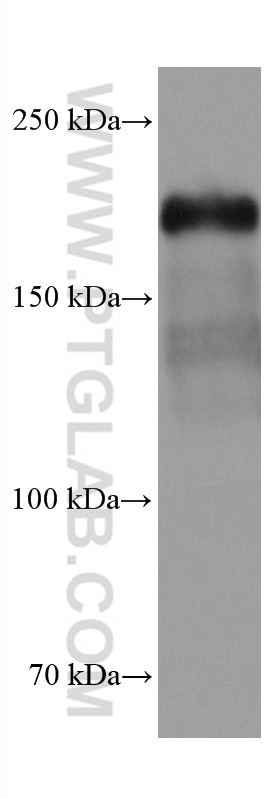 Western Blot (WB) analysis of SKOV-3 cells using ZEB1 Monoclonal antibody (66279-1-Ig)