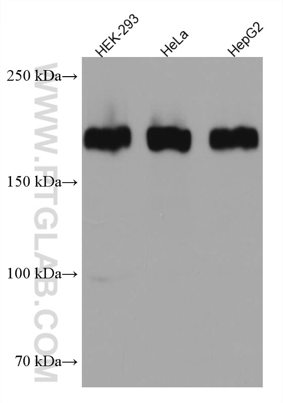 Western Blot (WB) analysis of various lysates using ZEB1 Monoclonal antibody (66279-1-Ig)