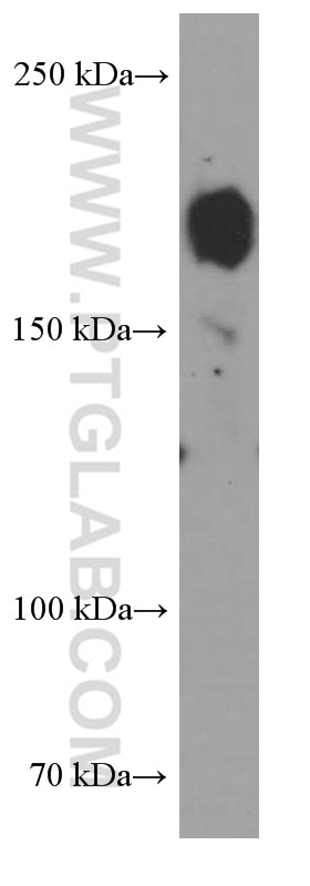 Western Blot (WB) analysis of Jurkat cells using ZEB1 Monoclonal antibody (66279-1-Ig)