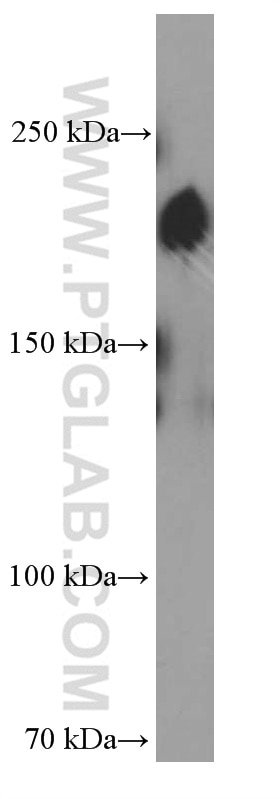 Western Blot (WB) analysis of HeLa cells using ZEB1 Monoclonal antibody (66279-1-Ig)