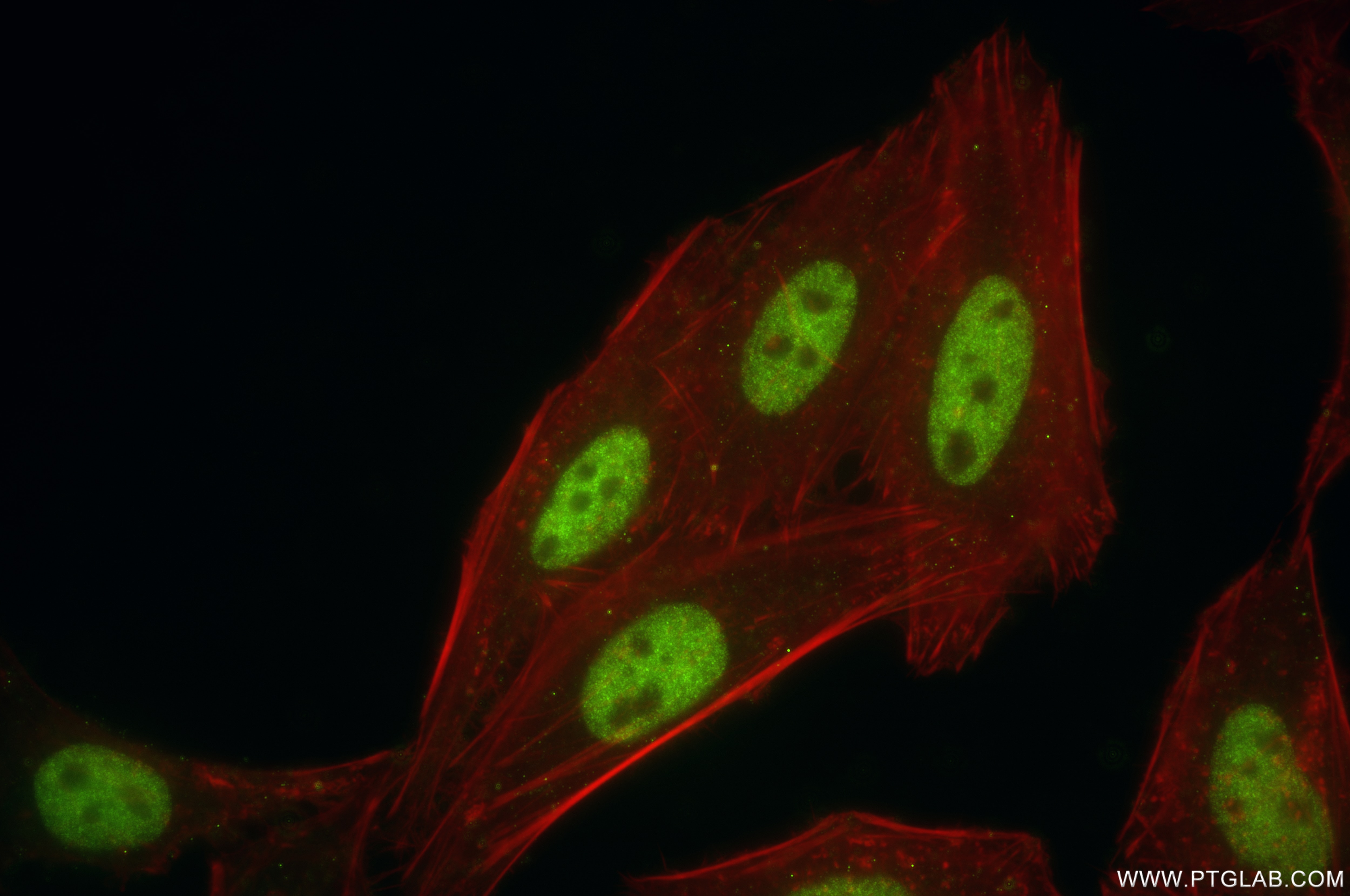 Immunofluorescence (IF) / fluorescent staining of HeLa cells using ZEB1 Recombinant antibody (85729-1-RR)