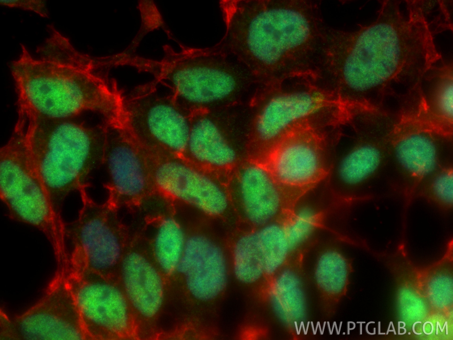 Immunofluorescent analysis of (4% PFA) fixed HEK-293 cells using ZEB1 antibody (85729-1-RR, Clone: 243139F8 ) at dilution of 1:200 and CoraLite®488-Conjugated Goat Anti-Rabbit IgG(H+L) (SA00013-2), CL594-phalloidin (red). Immunofluorescence (IF) / fluorescent staining of HEK-293 cells using ZEB1 Recombinant monoclonal antibody (85729-1-RR)