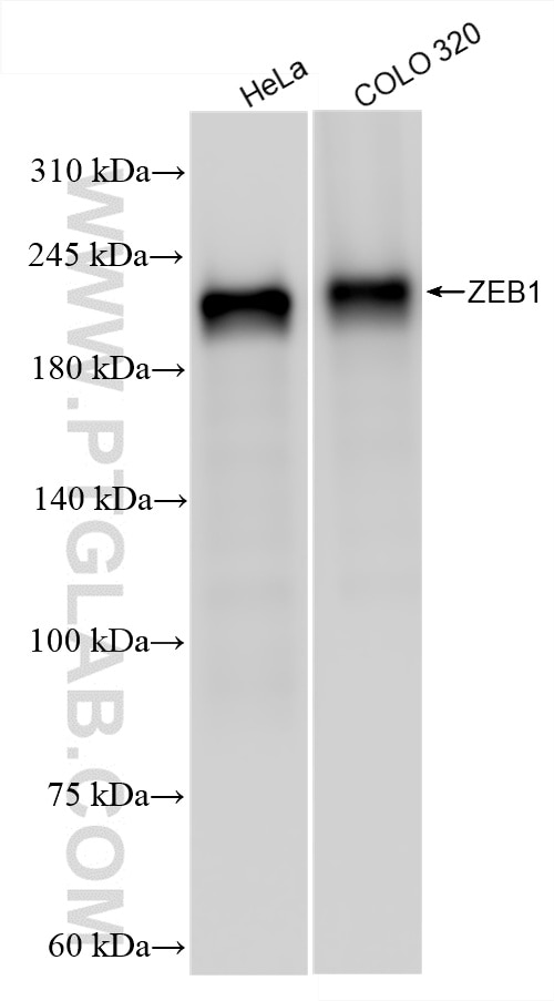 Western Blot (WB) analysis of various lysates using ZEB1 Recombinant antibody (85729-1-RR)