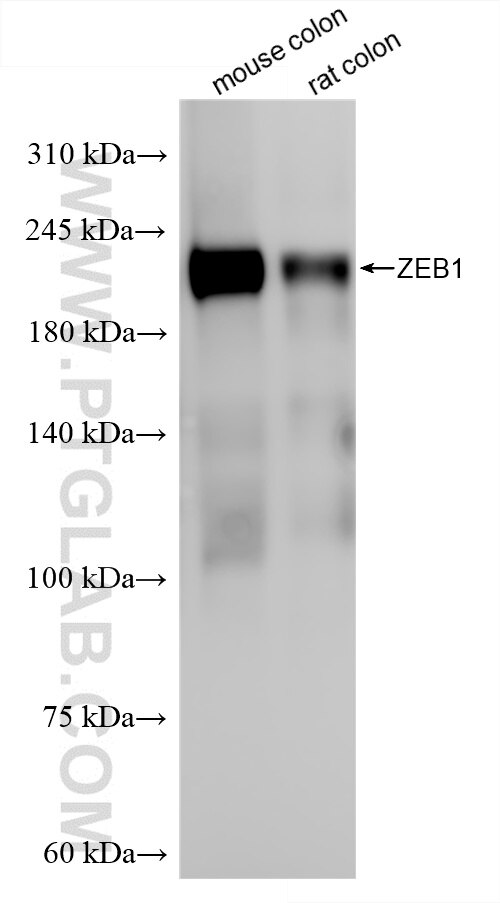Western Blot (WB) analysis of various lysates using ZEB1 Recombinant antibody (85729-1-RR)