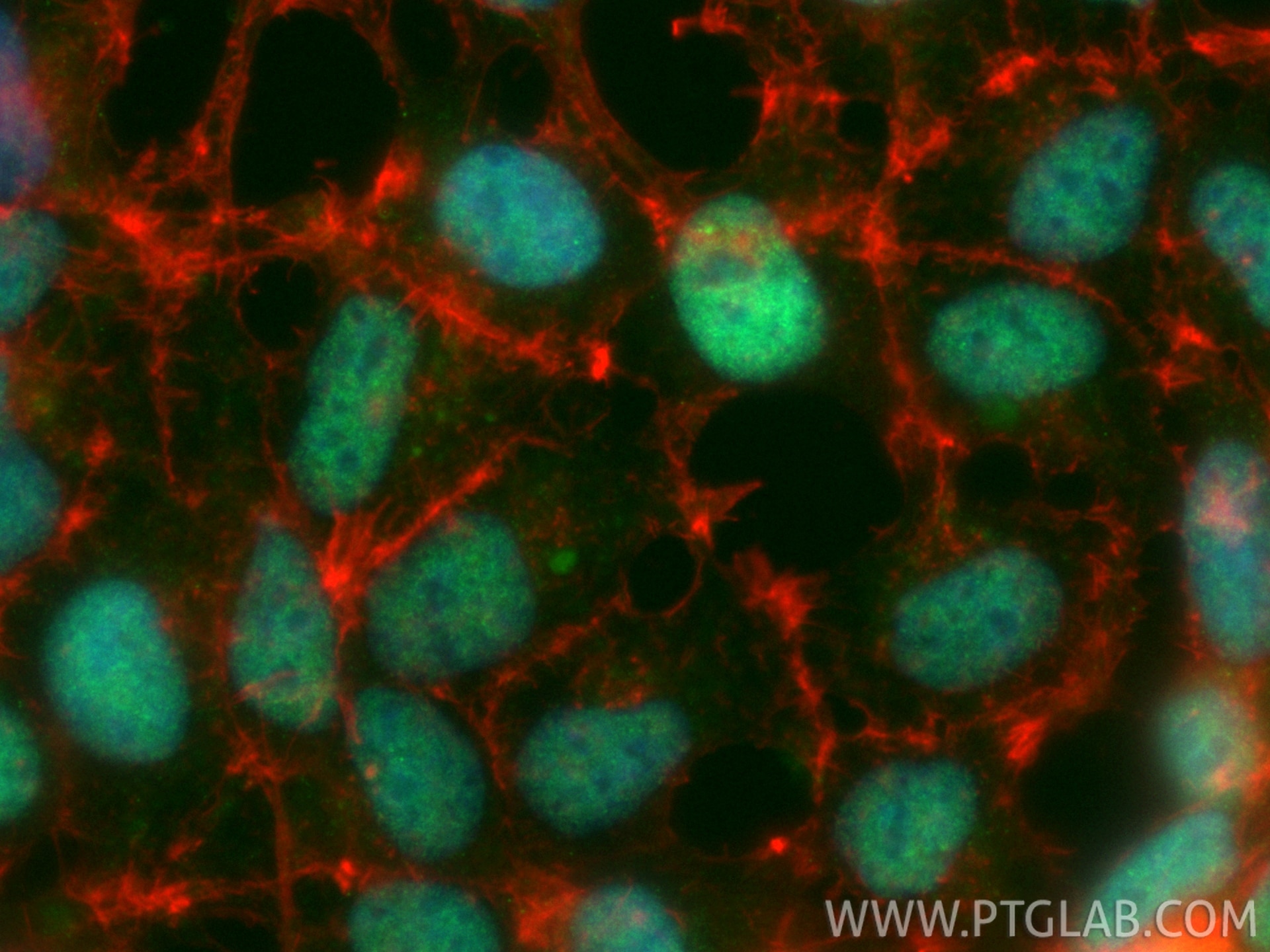 Immunofluorescent analysis of (4% PFA) fixed HEK-293 cells using CoraLite® Plus 488 ZEB1 antibody (CL488-85729, Clone: 243139F8 ) at dilution of 1:200, CL594-phalloidin (red). Immunofluorescence (IF) / fluorescent staining of HEK-293 cells using CoraLite® Plus 488-conjugated ZEB1 Recombinant mon (CL488-85729)