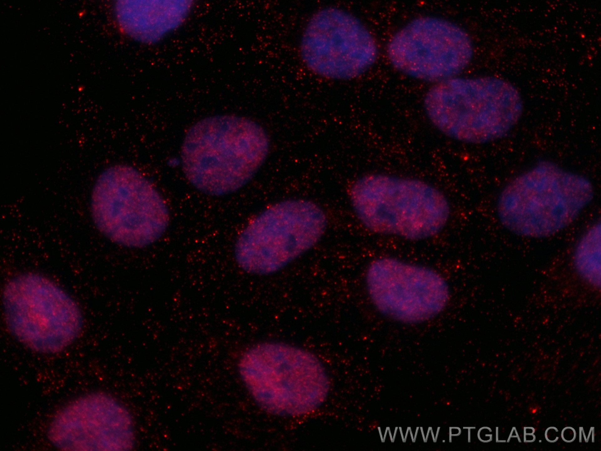 Immunofluorescence (IF) / fluorescent staining of U2OS cells using CoraLite®594-conjugated ZEB1 Monoclonal antibody (CL594-66279)