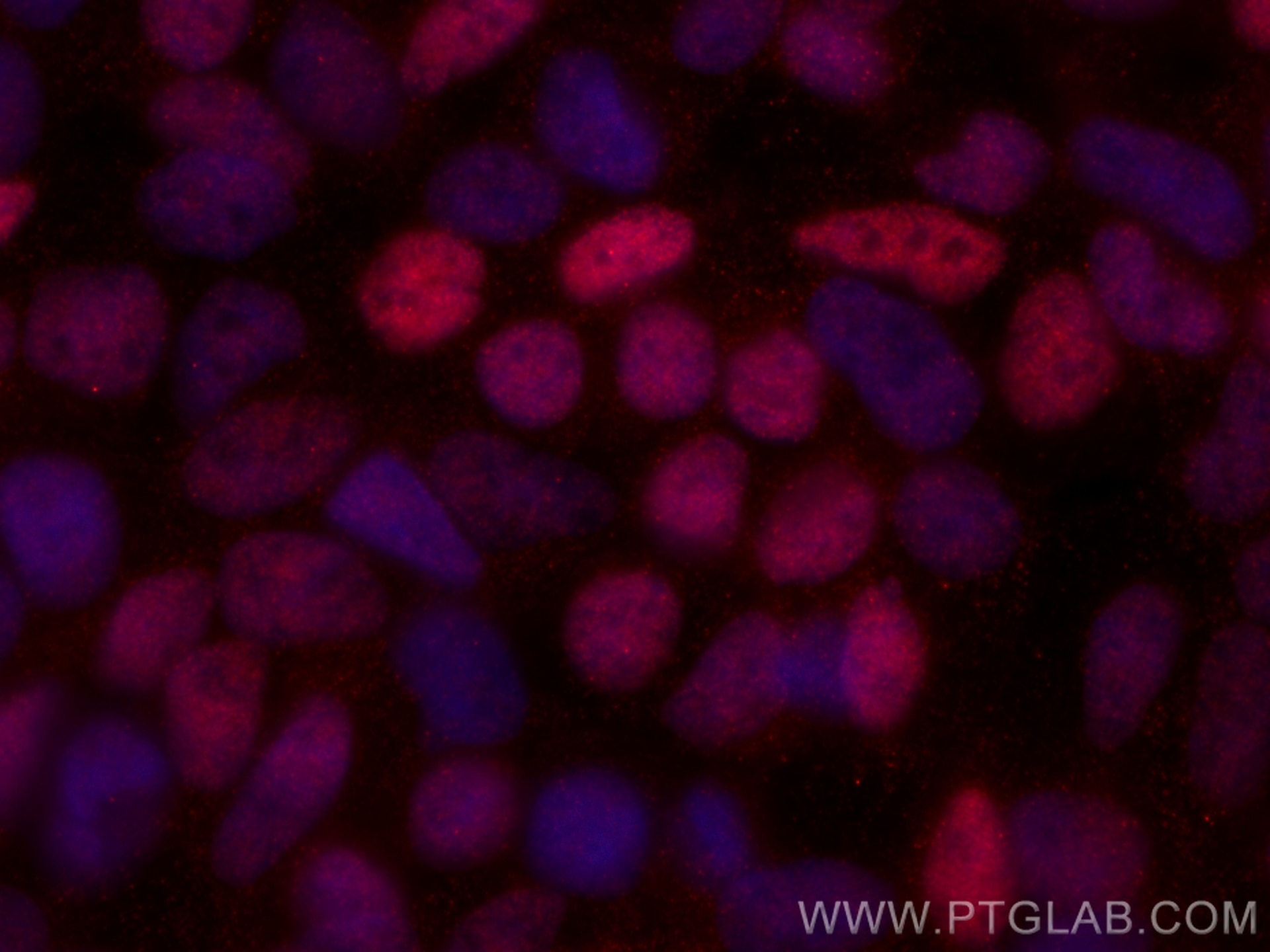 Immunofluorescence (IF) / fluorescent staining of HEK-293 cells using CoraLite®594-conjugated ZEB1 Monoclonal antibody (CL594-66279)