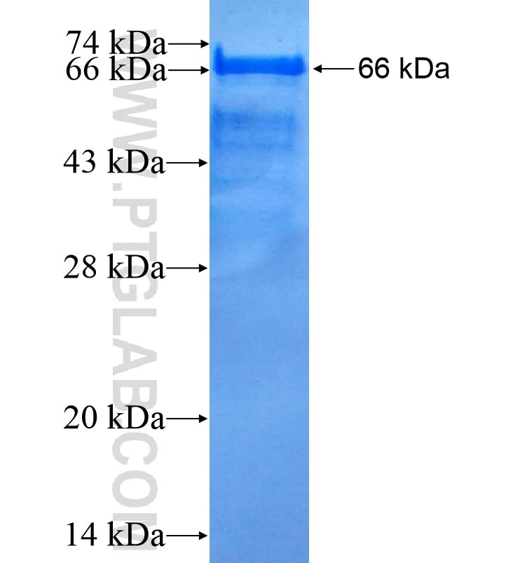 ZEB1 fusion protein Ag16204 SDS-PAGE