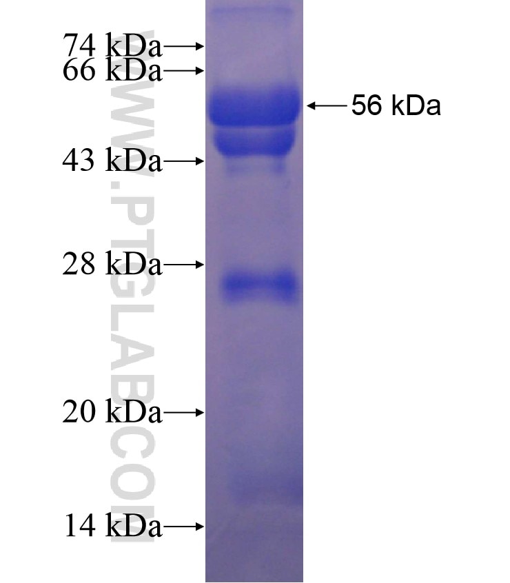 ZEB1 fusion protein Ag17118 SDS-PAGE
