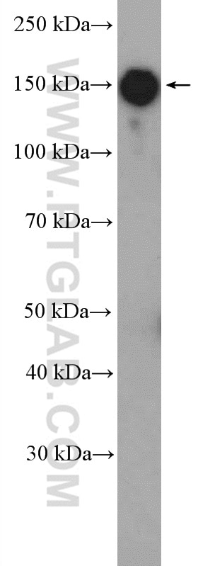 ZEB2 Polyclonal antibody