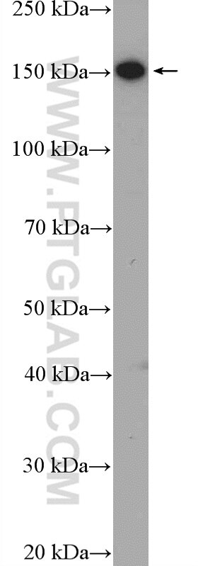 Western Blot (WB) analysis of SGC-7901 cells using ZEB2 Polyclonal antibody (14026-1-AP)