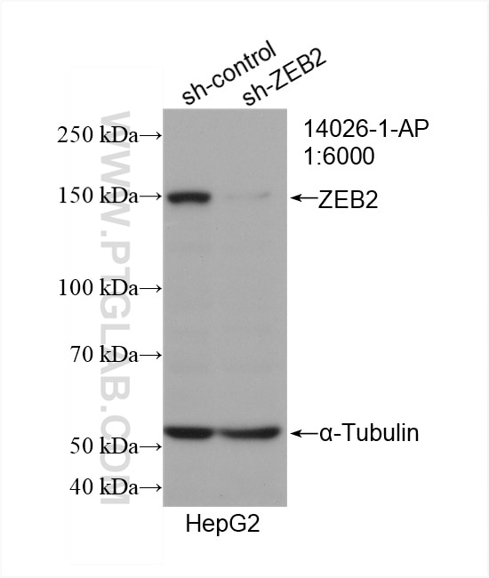 Western Blot (WB) analysis of HepG2 cells using ZEB2 Polyclonal antibody (14026-1-AP)