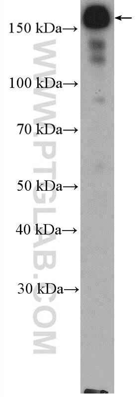 Western Blot (WB) analysis of HepG2 cells using ZEB2 Polyclonal antibody (14026-1-AP)