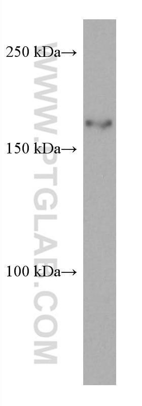 Western Blot (WB) analysis of K-562 cells using ZEB2 Monoclonal antibody (67514-1-Ig)