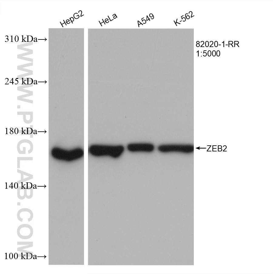 Western Blot (WB) analysis of various lysates using ZEB2 Recombinant antibody (82020-1-RR)
