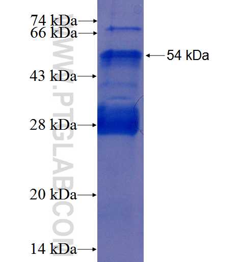 ZEB2 fusion protein Ag25477 SDS-PAGE