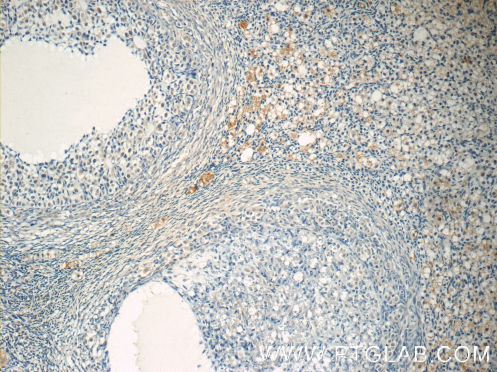 Immunohistochemistry (IHC) staining of human ovary tissue using ZER1 Polyclonal antibody (16647-1-AP)