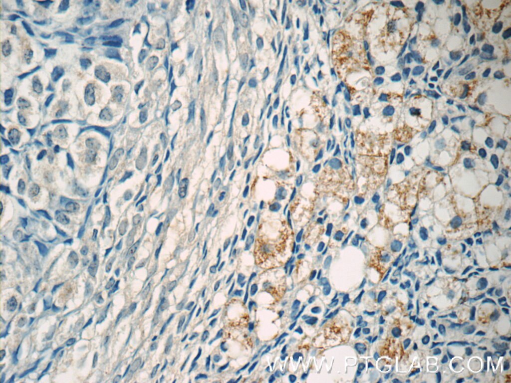 Immunohistochemistry (IHC) staining of human ovary tissue using ZER1 Polyclonal antibody (16647-1-AP)