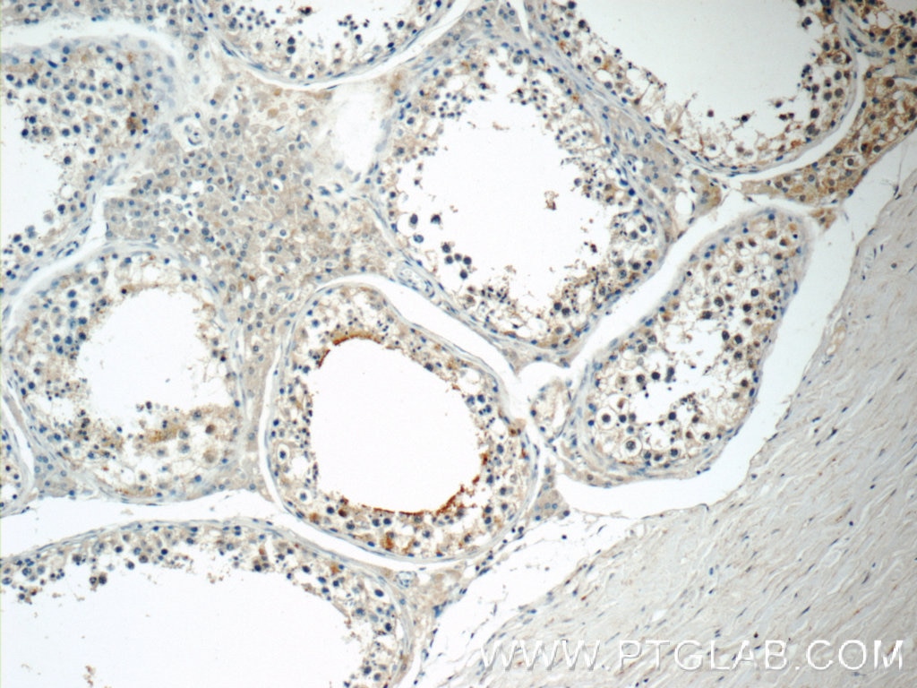 Immunohistochemistry (IHC) staining of human testis tissue using ZER1 Polyclonal antibody (16647-1-AP)