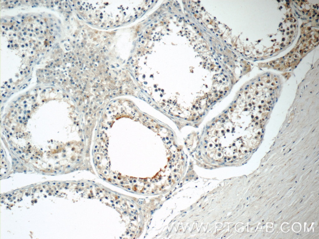 IHC staining of human testis using 16647-1-AP