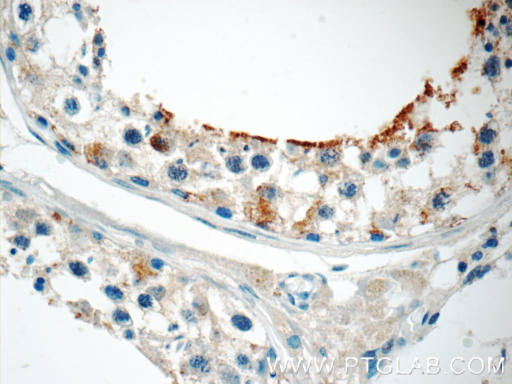 Immunohistochemistry (IHC) staining of human testis tissue using ZER1 Polyclonal antibody (16647-1-AP)