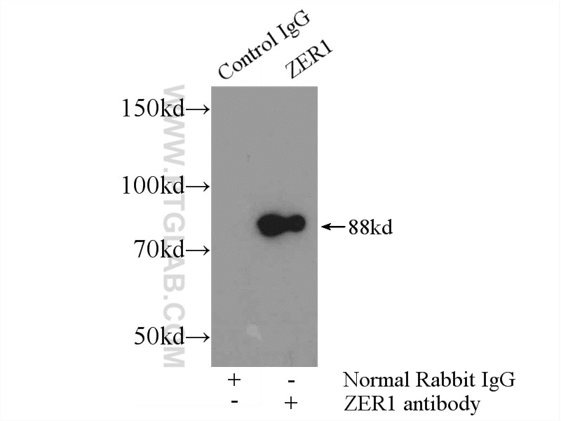 Immunoprecipitation (IP) experiment of mouse testis tissue using ZER1 Polyclonal antibody (16647-1-AP)